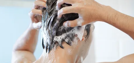 How To Get Rid of Dandruff: Treatment Options That Actually Work!