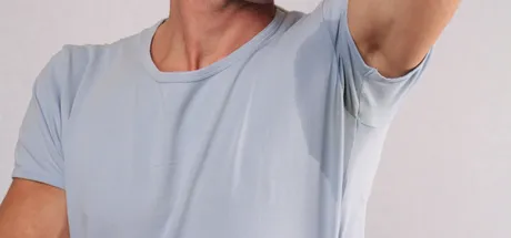 How to Manage Excessive Sweating & Boost Confidence All-Year Round!