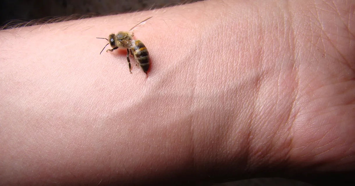 What Bug Bit Me? How to Identify Common Insect Bites