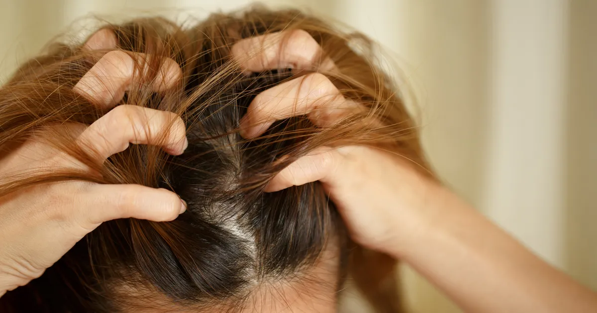 The Best Shampoos for Itchy Scalps Weldricks Pharmacy