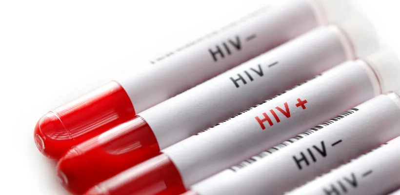 HIV: Promising new approach