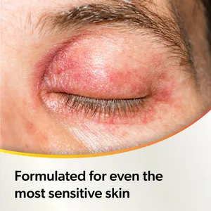 Optase Protect Eyelid Cleansing Spray 100ml