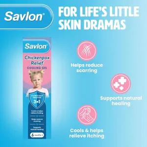 Savlon Chickenpox Relief Cooling Gel 75g